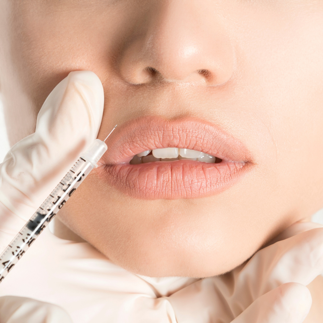 ip askılama istanbul