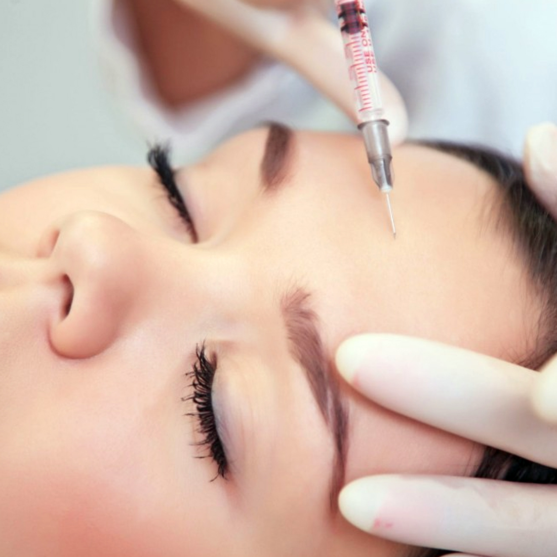 ip askılama istanbul