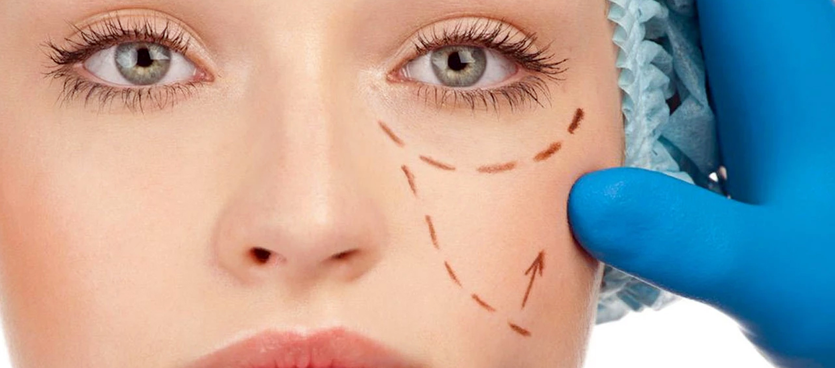 örümcek ağı uygulaması