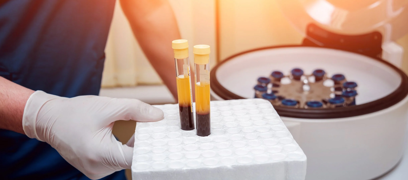 Plazma Tedavisi uygulaması