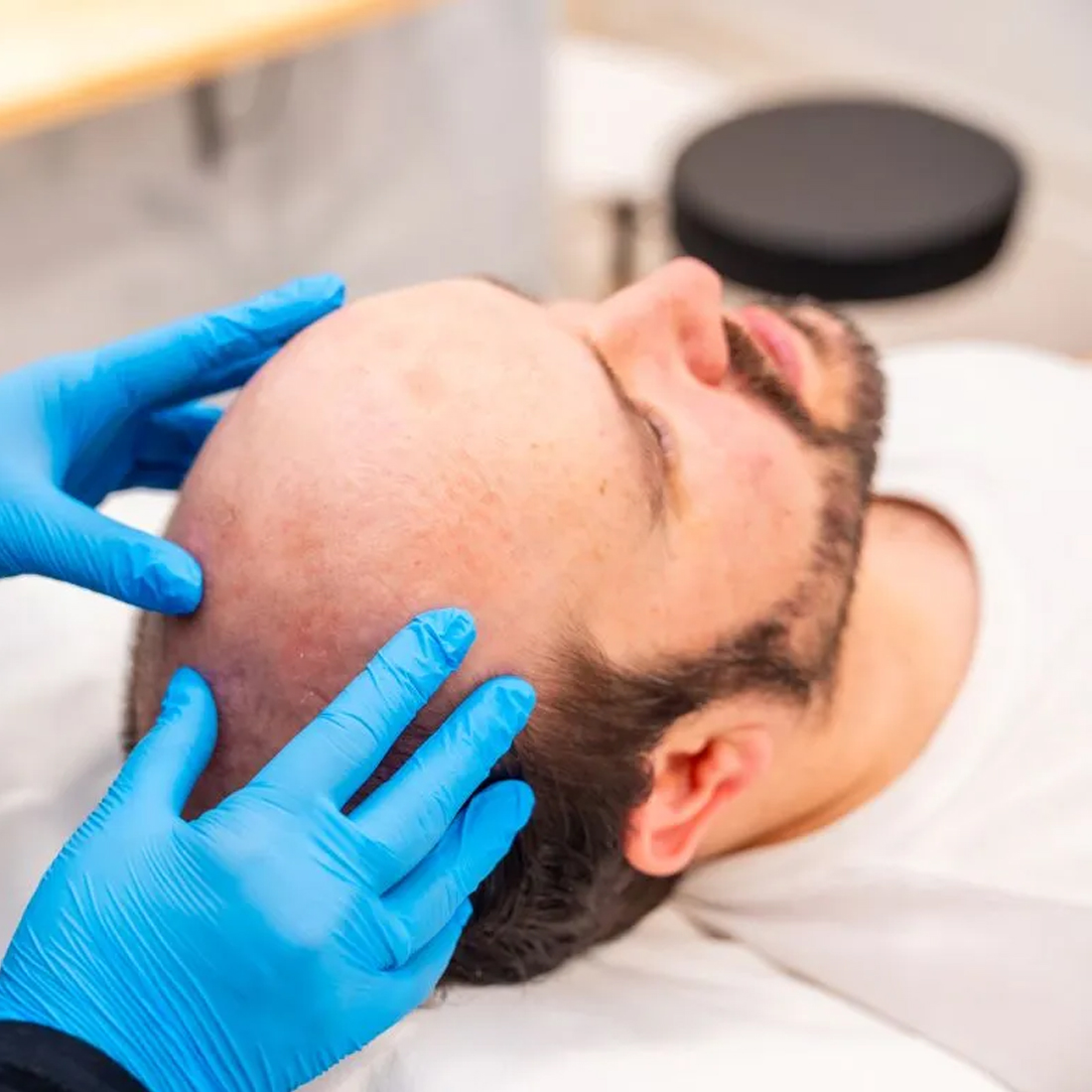 saç ekimi nişantaşı