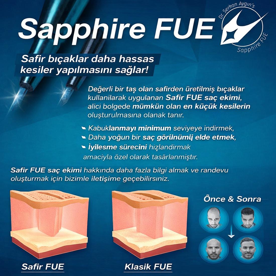 saç ekimi istanbul