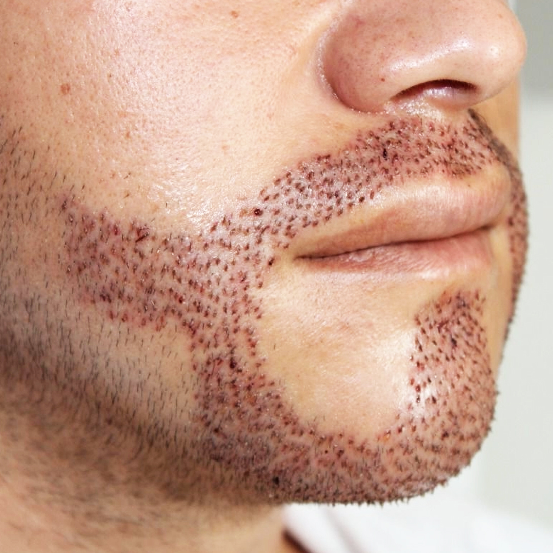 Sakal Ekimi nişantaşı